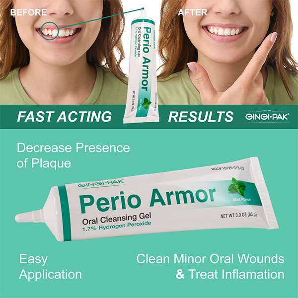 Perio Armor 1.7% HP Oral Cleansing Gel - Image 9